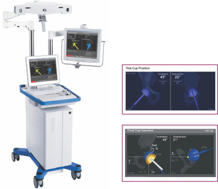 Navigation Robotic-assisted knee and hip Surgeon